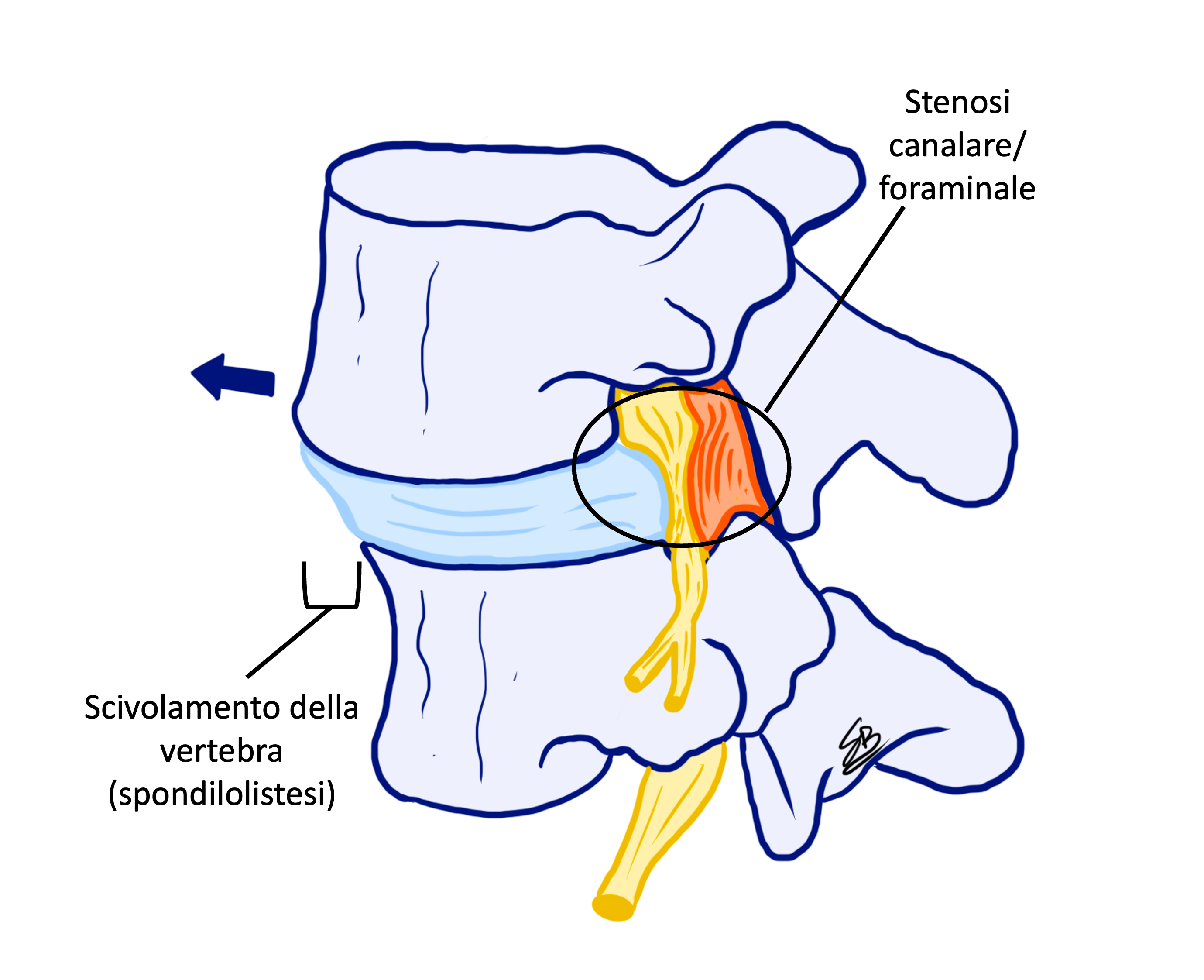 fig 17